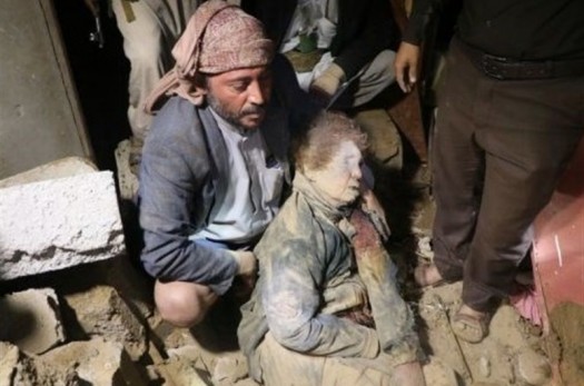 جان باختن ۱۴۰۰ کودک یمنی طی ۲ سال تجاوز عربستان به یمن